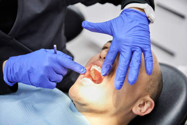 Best Emergency Tooth Extraction in Pine Knot, KY